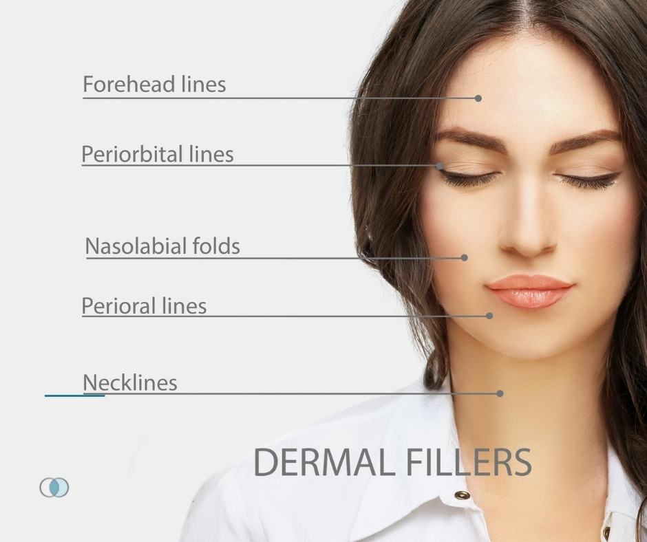 Should You Get HA Fillers … or Something Else? | Palo Alto Laser