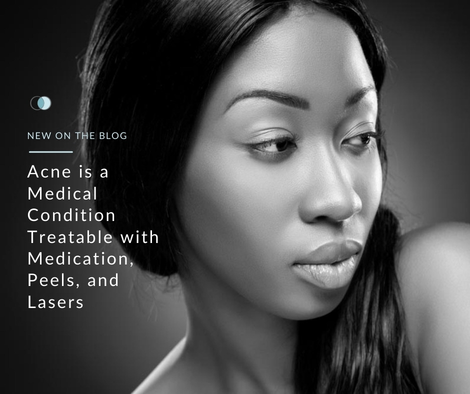 Acne is a Treatable Medical Condition | Palo Alto Laser & Skin Care