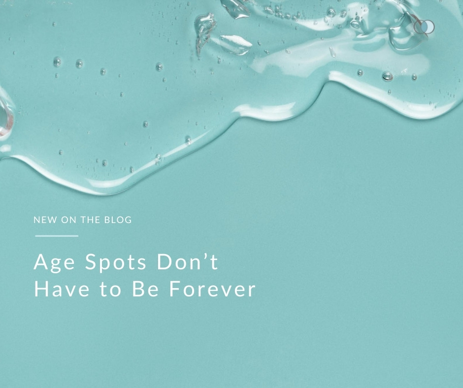 Age Spots Don’t Have to Be Forever | Palo Alto Laser & Skin Care
