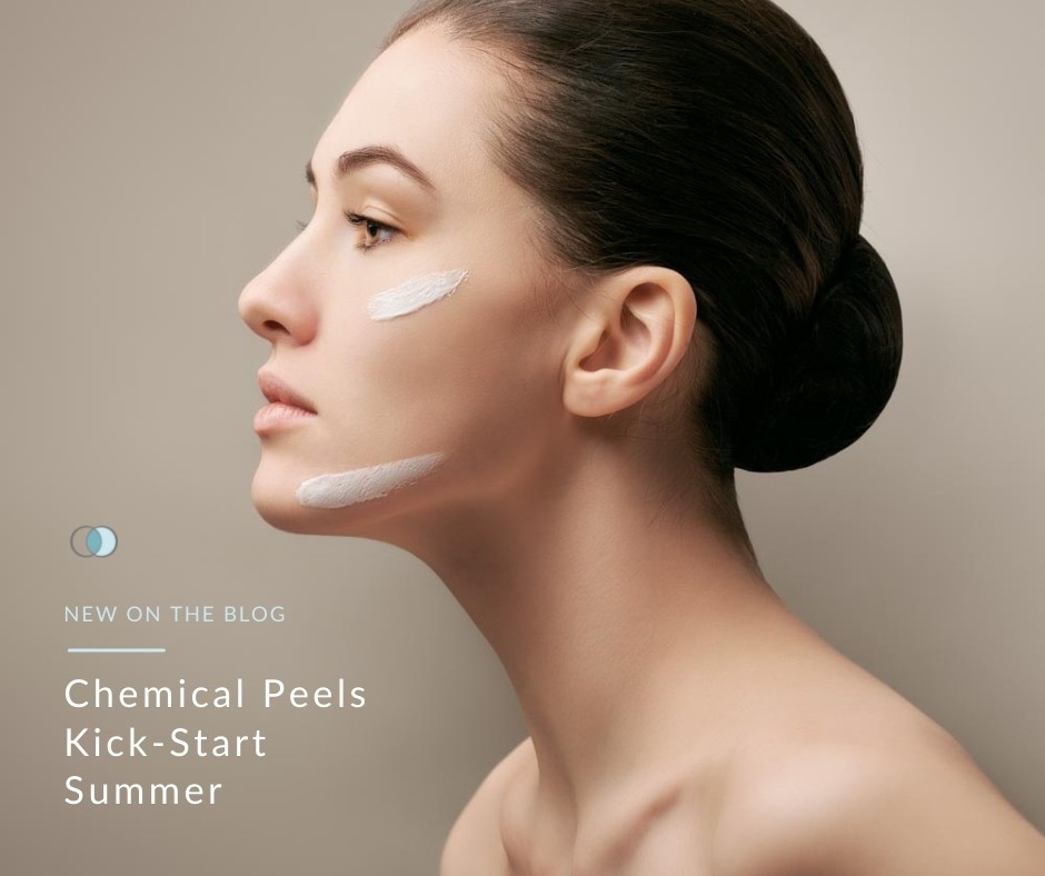 Chemical Peels Kick-Start Summer