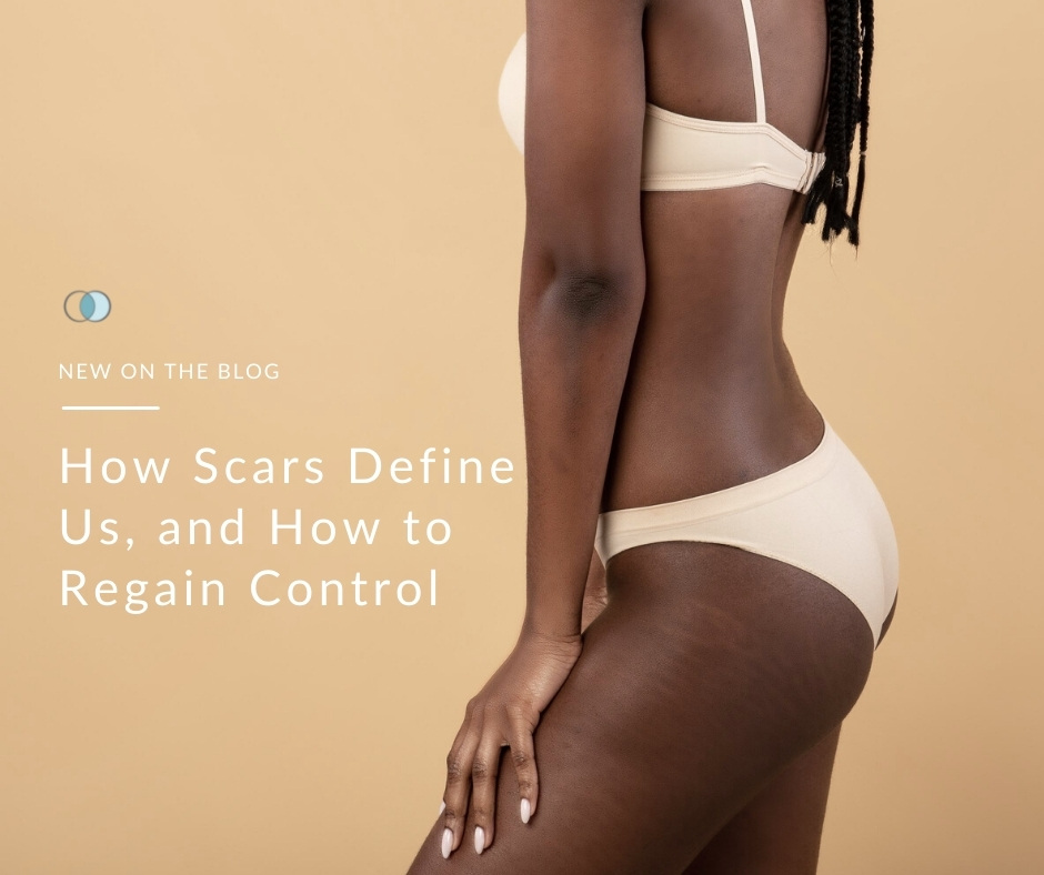 How Scars Define Us, and How to Regain Control | Palo Alto Laser