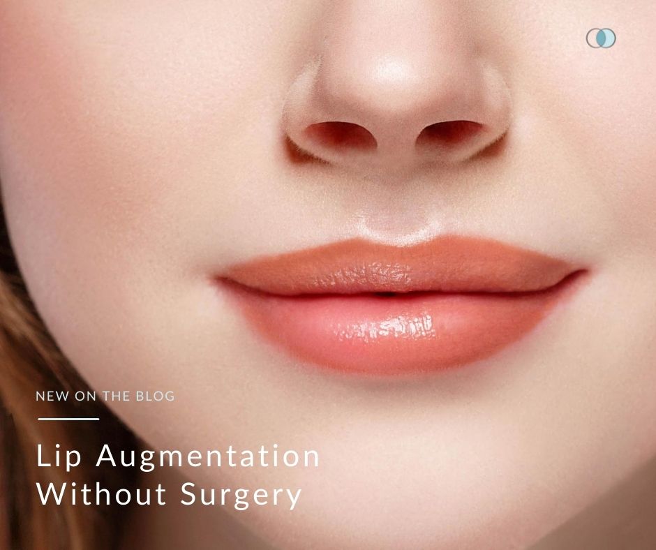 Lip Augmentation Without Surgery | Palo Alto Laser & Skin Care