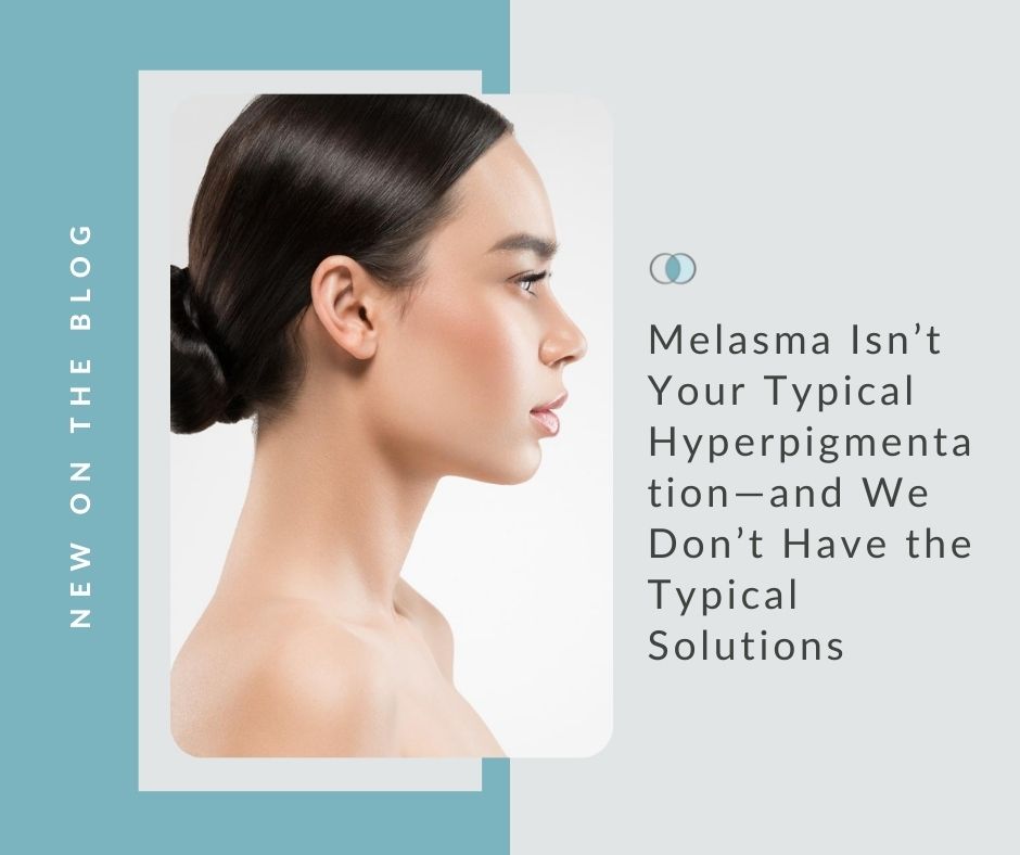 Melasma Isn’t Your Typical Hyperpigmentation—and We Don’t Have the Typical Solutions | Palo Alto Laser & Skin Care
