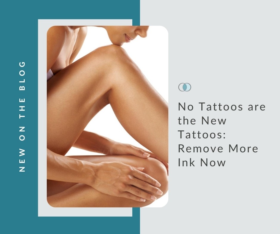 No Tattoos are the New Tattoos