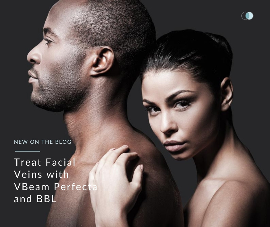 Treat Facial Veins with VBeam Perfecta and BBL | Palo Alto Laser & Skin Care